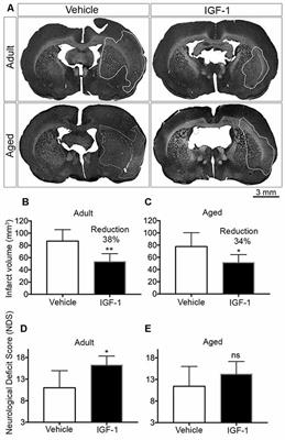 Insulin-Like Growth Factor-1 Is Neuroprotective in Aged Rats With Ischemic Stroke